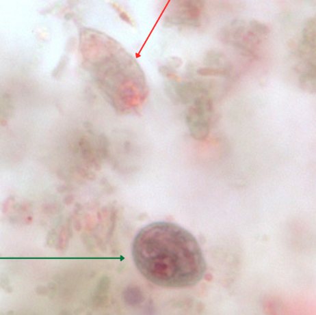 <ul><li><p style="text-align: justify;"><span style="background-color: transparent;"><span>Identify the organism and developmental stage pointed by the red arrow.</span></span></p><ul><li><p style="text-align: justify;">(1)</p></li></ul></li><li><p style="text-align: justify;"><span style="background-color: transparent;"><span>Identify the organism and developmental stage pointed by the green arrow.</span></span></p><ul><li><p style="text-align: justify;">(2)</p></li></ul></li></ul><p></p>