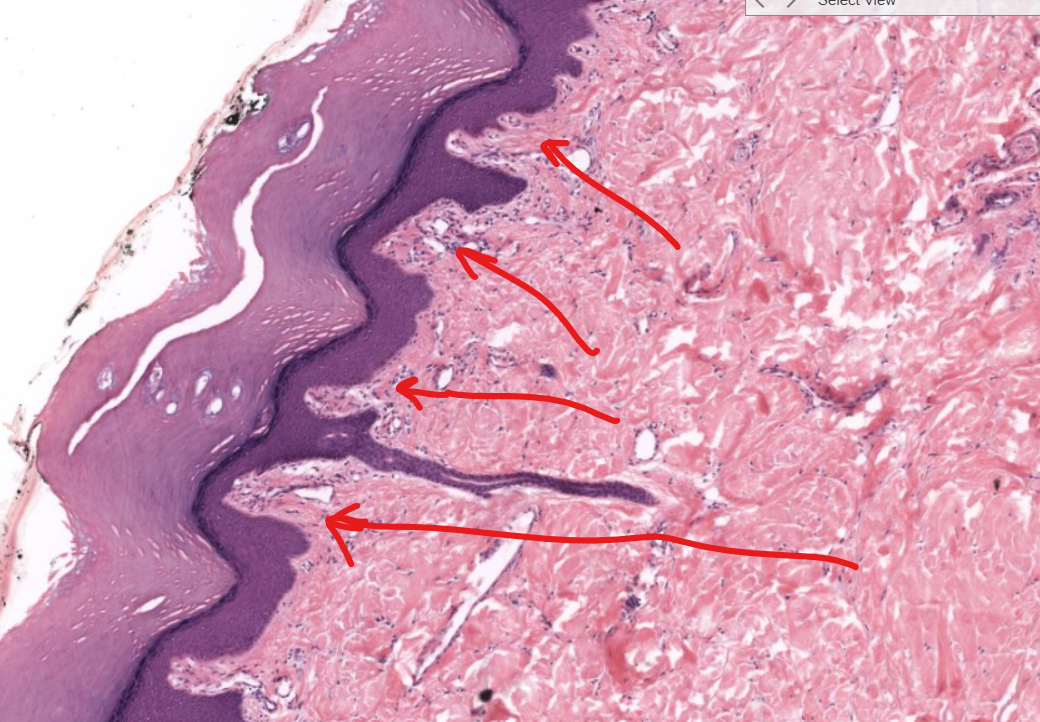 <p>(structure)</p>
