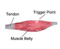 <p>PORTION OF MUSCLE<strong> BETWEEN ORIGIN AND INSERTION</strong></p>
