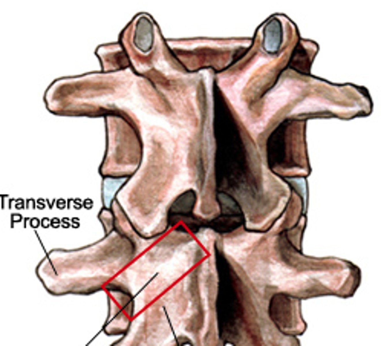 <p>What part of the vertebra is this?</p>