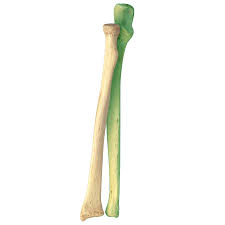 <p>pinky side of forearm</p>