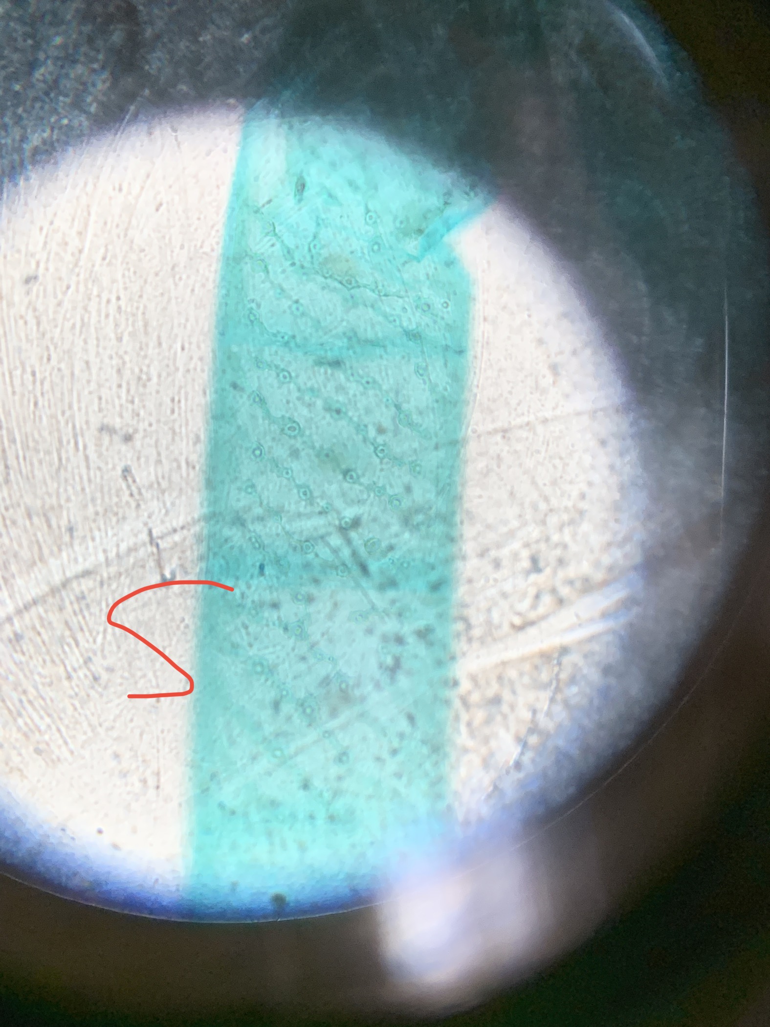 <p>protist?</p>