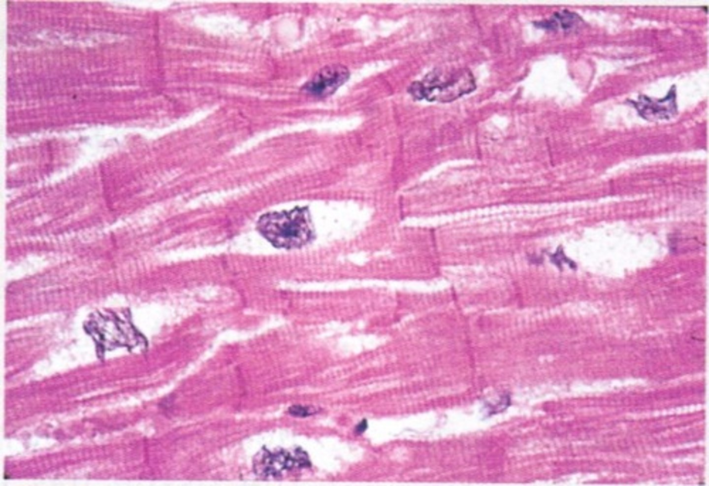 <p>Only found in the heart. Involuntary action muscle. Striated and uninuclear.</p>