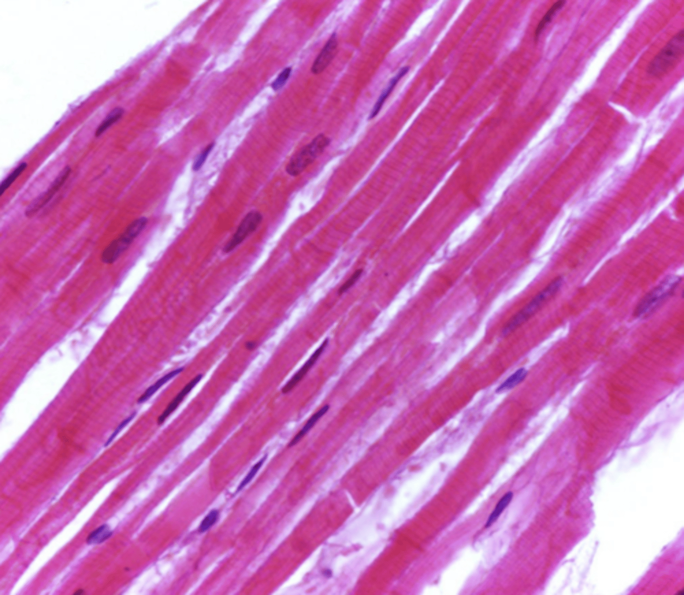 <p>which type of muscle tissue? how can you tell?</p>