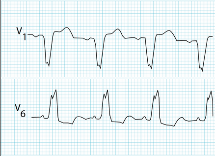 <p>type of abnormality + characteristics?</p>