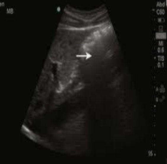 <p>what type of artifact is this?</p>