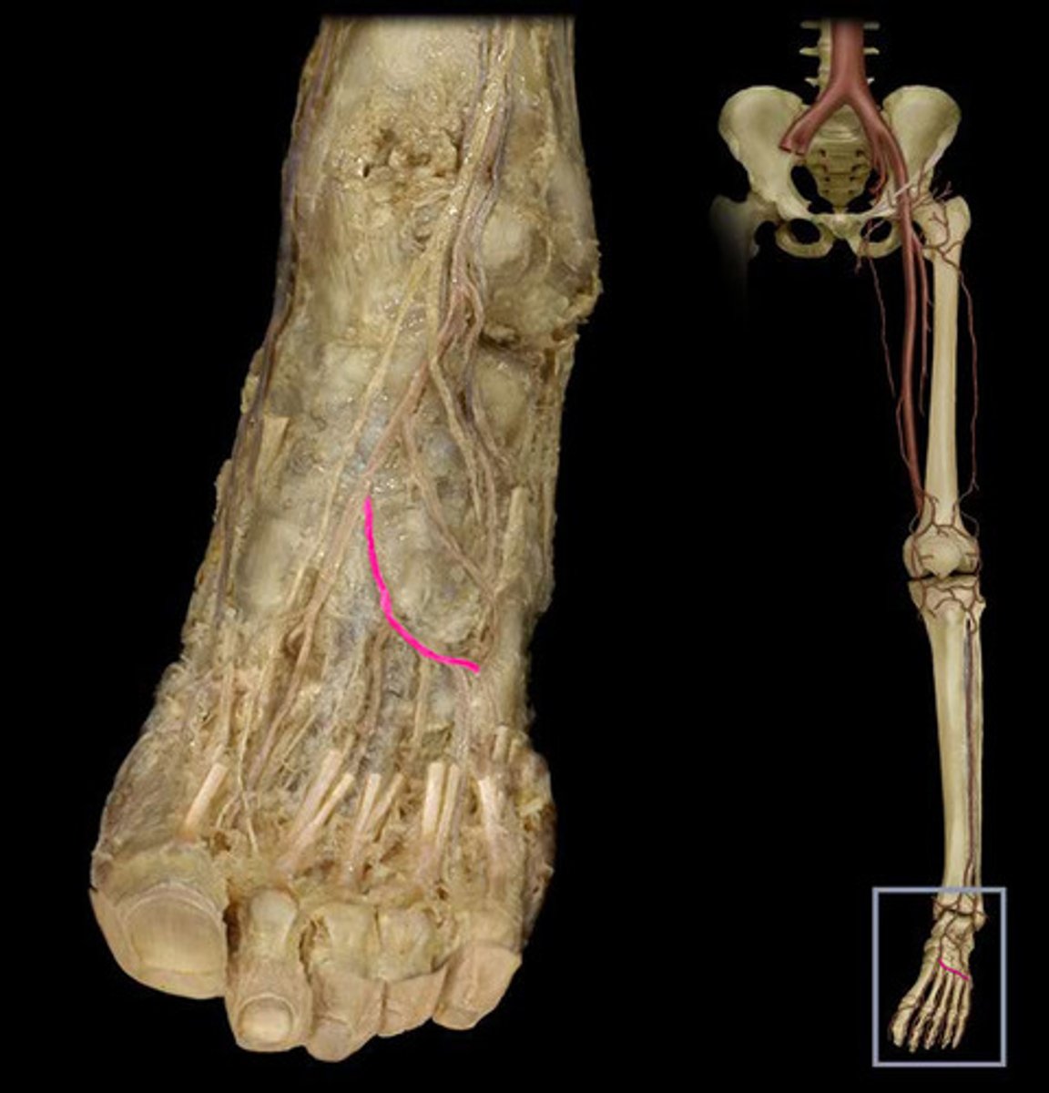 <p>Anastomoses with the lateral tarsal artery to form an arterial loop. Gives rise to 2nd-4th dorsal metatarsal arteries. Under the extensor digitorum brevis.</p>