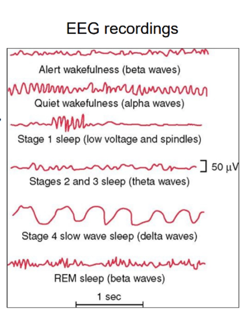 <p>while falling asleep EEG rhythms get slower and higher in amplitude until reaching NREM sleep.</p><p>REM and wake look similar on EEG</p>