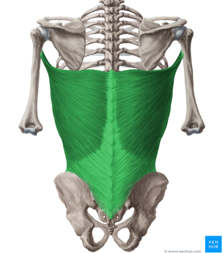 term image