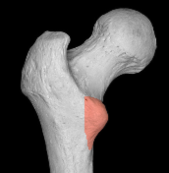 <p>smaller medial projection off proximal end of femur</p>