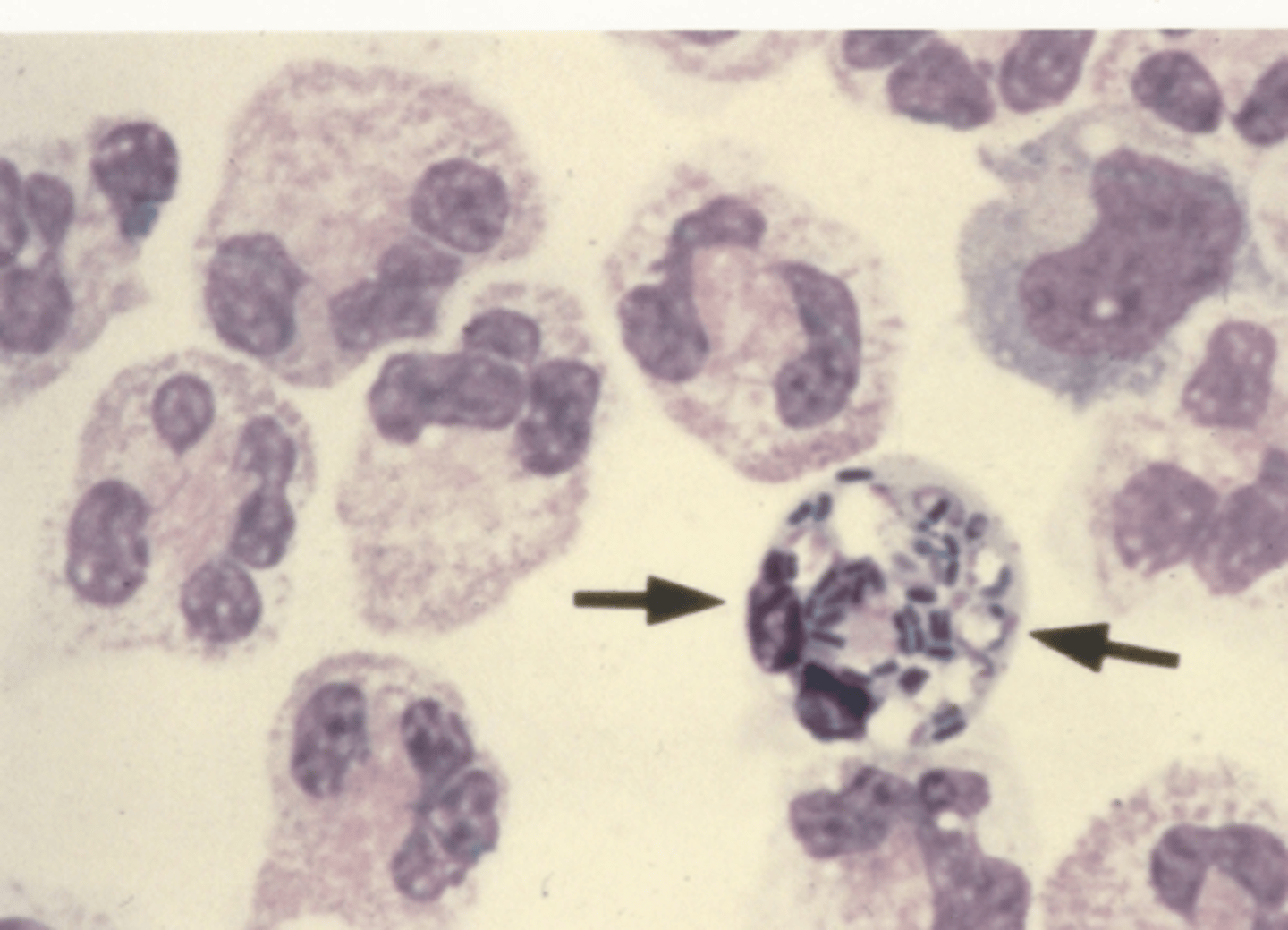 <p>Identify the cells in this body fluid</p>