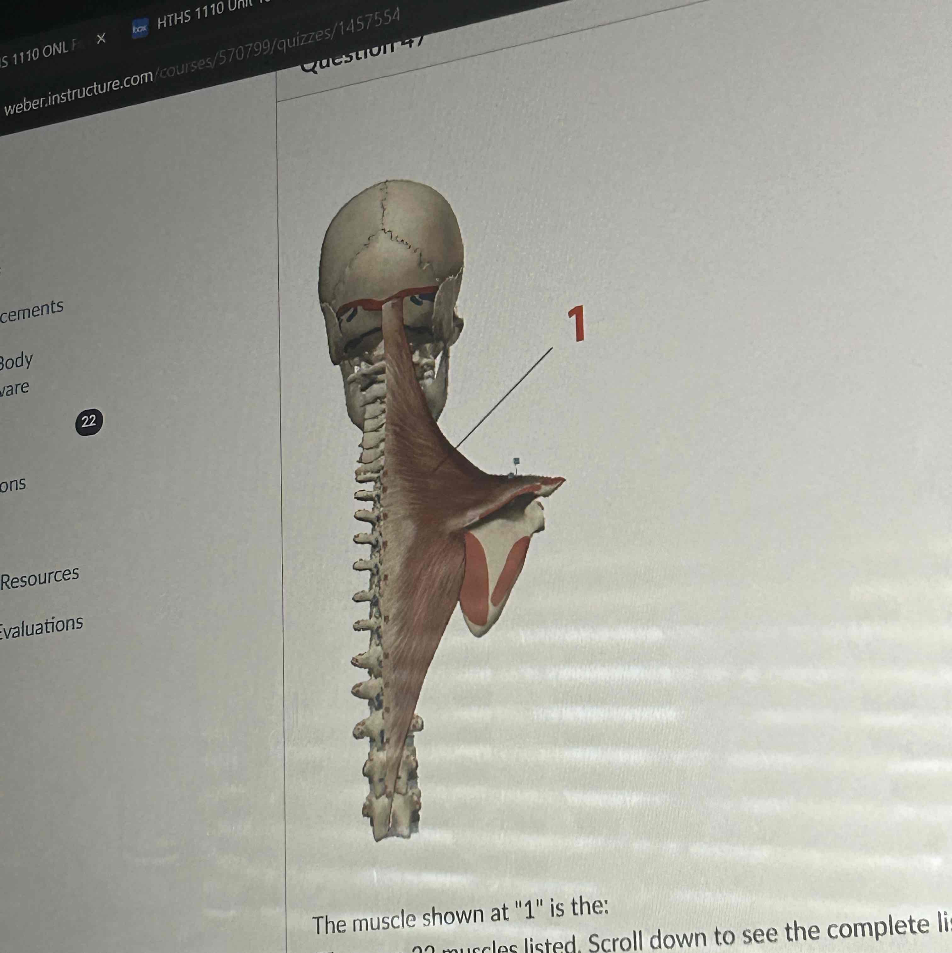 <p>The muscle shown at 1 is the </p>