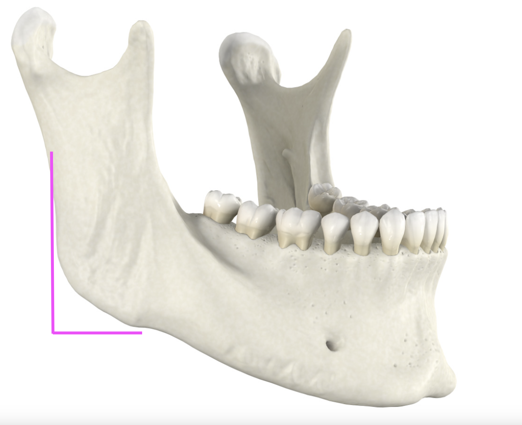 <p>What bone marking is this?</p>