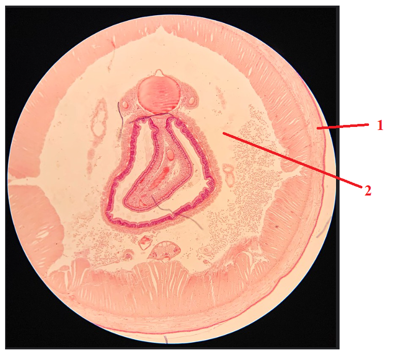 <p>Phylum?Class?<br>Symmetry? Tissue type?<br>Cavity?<br><br>1/2?</p>