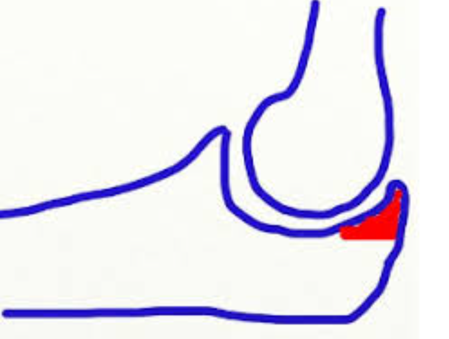 <p>proximal ulna, elbow</p>