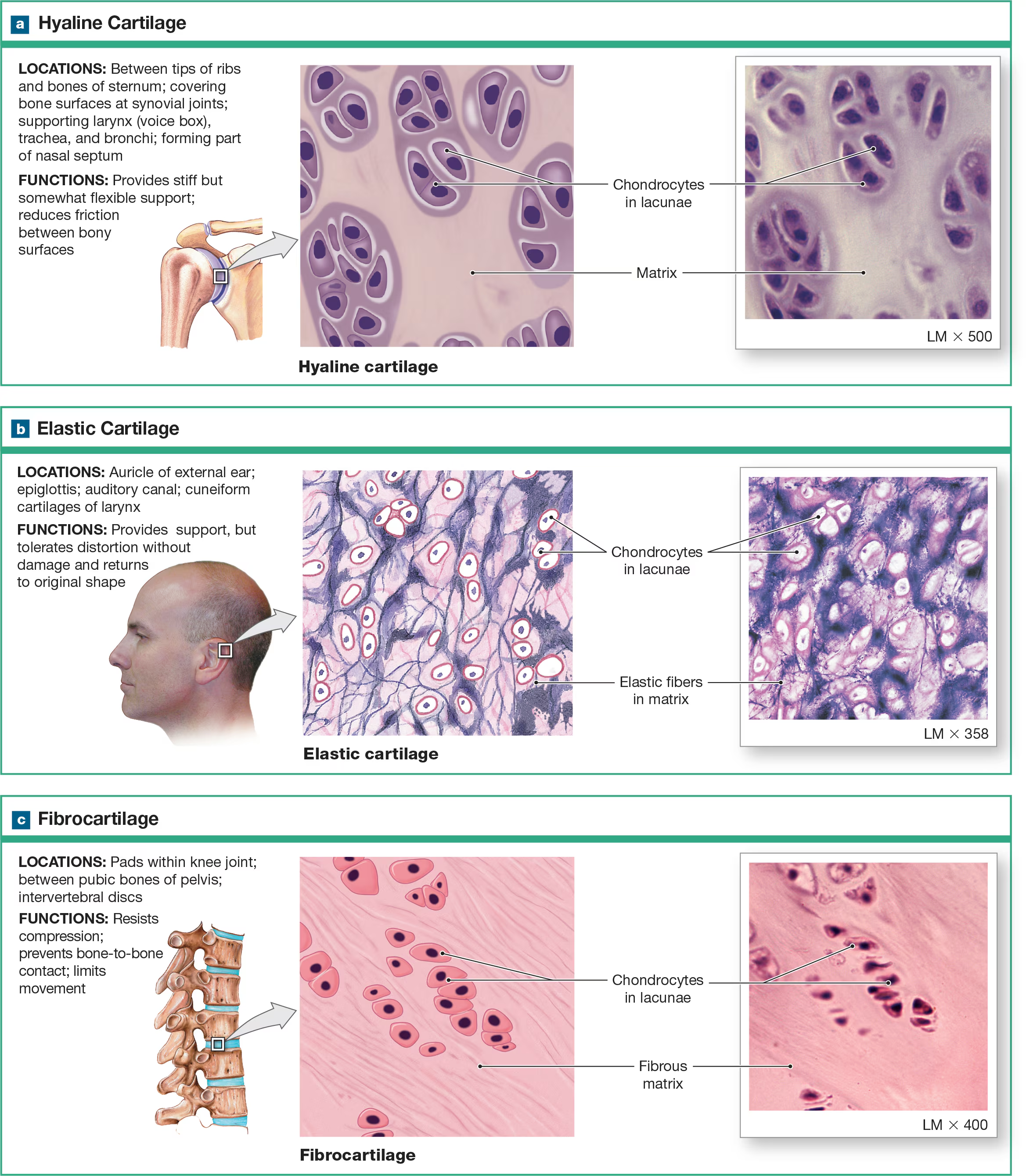 <p>Fibrocartilage </p>