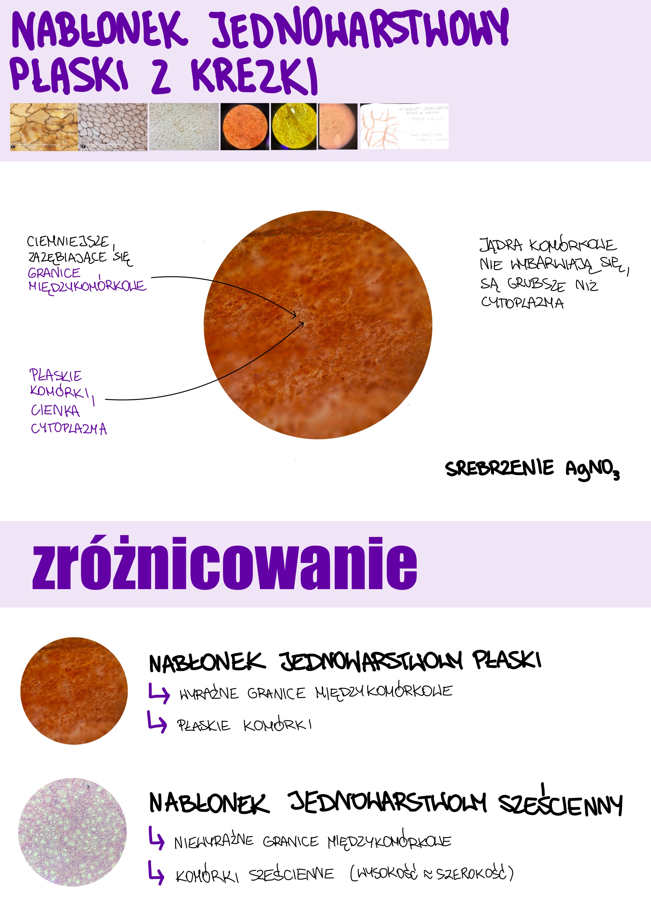 <p>Nabłonek jednowarstwowy płaski z krezki</p>