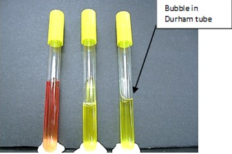 <ul><li><p><strong>Purpose</strong>: to distinguish carbohydrate fermenters from non-fermenters &amp; to detect and distinguish the different, specific carbohydrates by the products formed</p></li><li><p><strong>Medium</strong>: 0.5% to 1% carbohydrate (dextrose/lactose/sucrose) broth, peptone, with phenol red and an inverted Durham tube for detection of gas.</p></li><li><p><strong>Type of Medium:</strong> general purpose differential test media</p></li><li><p><strong>+ results</strong> = turns from red to yellow</p></li><li><p><strong>- results</strong> = no color change</p></li><li><p><strong>Gas production (+)</strong> = bubble trapped in an inverted Durham tube</p></li><li><p><strong>No gas production (-)</strong> = no bubble trapped in an inverted Durham tube</p></li><li><p><strong>significant specific ingredients:</strong></p></li><li><p><strong>reagents/indicators:</strong> phenol red as a pH indicator to indicate acid production</p></li><li><p><strong>specific directions</strong> (if any): inoculate tubes and incubate</p></li><li><p><strong>significant results:</strong></p><ul><li><p>AG = acid with gas production</p></li><li><p>A = acid, no gas</p></li><li><p>(-) = negative for acid and gas</p></li></ul></li></ul>