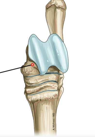 <p>Proximal tarsal bone; articulates with tibia and fibula proximally.</p>