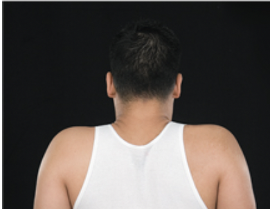 Raising a part of body