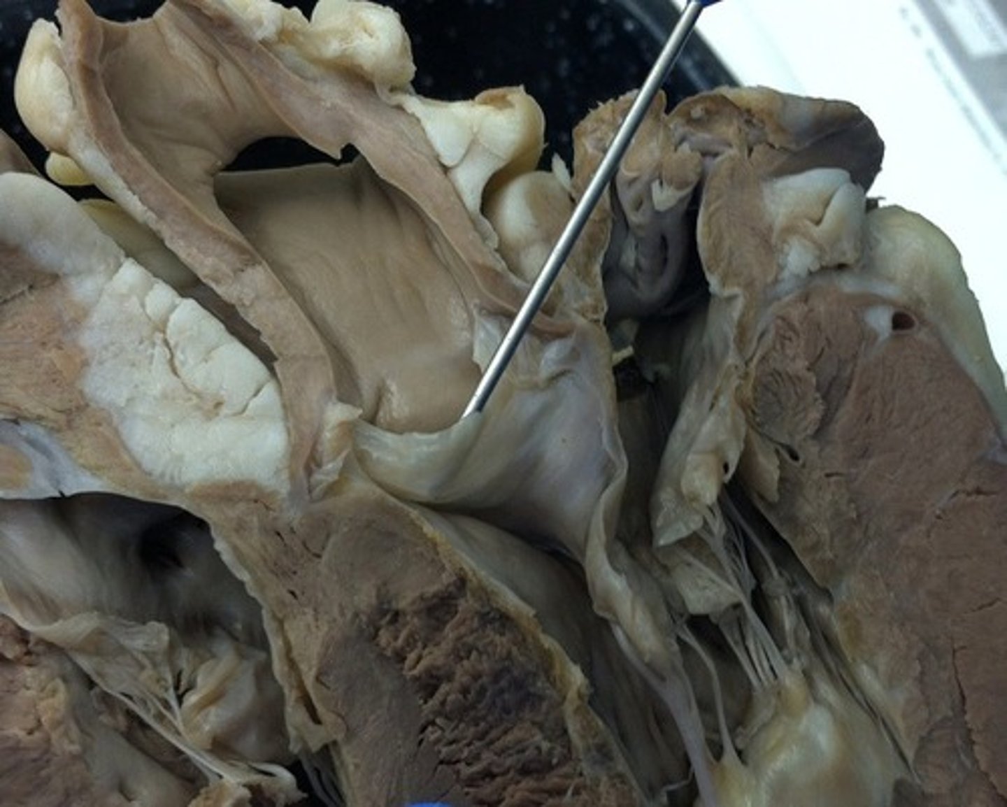 <p>Identify this Left heart valve:</p>