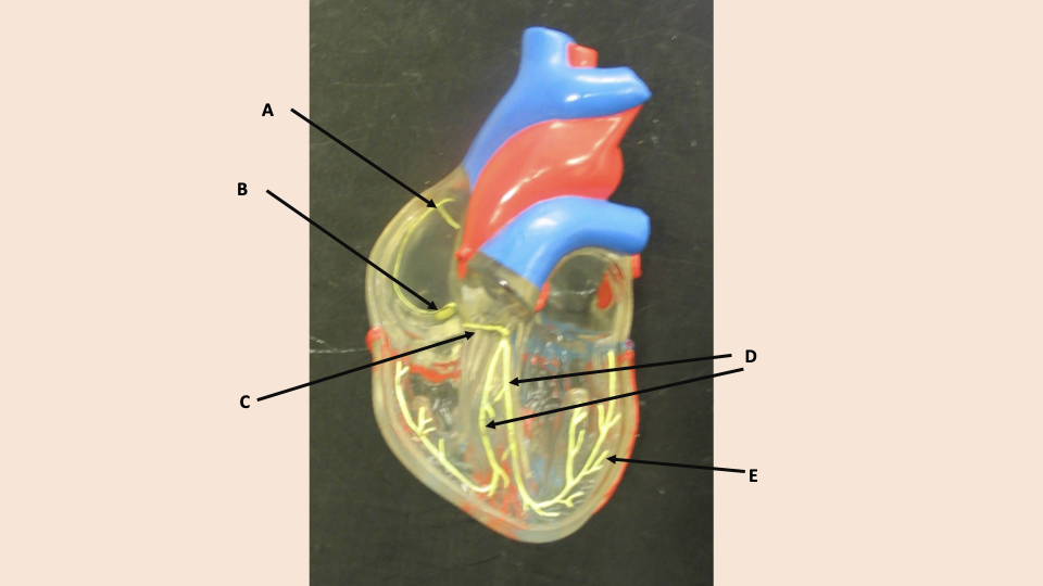 <p>what is A</p>
