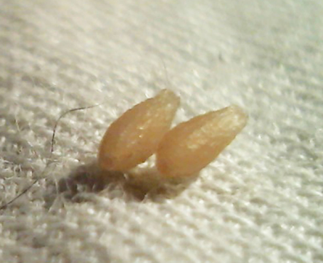 <p>Unique in that larval stage is strobilocercus</p><ol><li><p>Rodents ingest hexacanth eggs from cat feces, develop into cysticercus inside liver for 42 days</p></li><li><p>On day 42, cysticercus changes shape into strobilocercus with scolex and long neck attached to bladder (Cysticercus fasciolaris)</p></li><li><p>Cat infected by eating rat or mouse liver</p></li><li><p>Scolex attaches to cat intestine</p></li></ol><p></p>