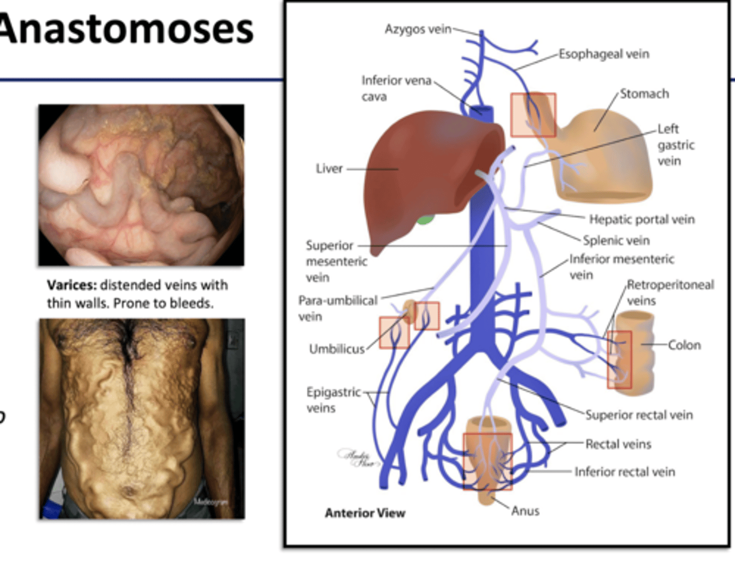 <p>- small connections between portal v. tributaries of vena cava</p><p>- walls of organs</p><p>- body wall around umbilicus</p><p>- emergency route for blood if liver has blockages</p>