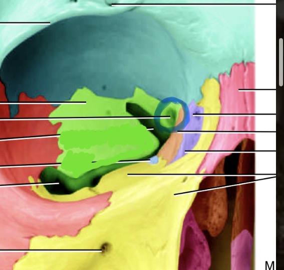 <p>What bone is the green one and its marking </p>