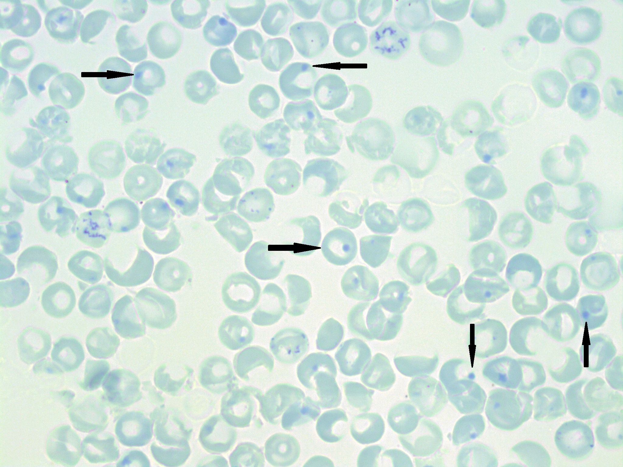 <ul><li><p>large cells appear bright blue due to staining</p><ul><li><p>a dot is visible on the edge of the cell</p></li></ul></li><li><p>results from denatured hemoglobin (Hgb has become unstable)</p></li><li><p>can only be visualized with <u>supravital stains</u> (such as brilliant cresyl blue)</p></li><li><p>mostly seen in G6PD deficiency</p></li></ul><p></p>