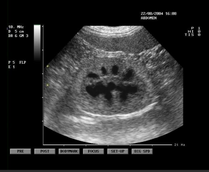 <ul><li><p>pelvis, cortex, and capsule are visible</p></li><li><p>adrenal glands are a dumbbell shape and are just cranial to the kidneys</p></li><li><p>Function:</p></li></ul><p>- production of urine to facilitate the elimination of metabolic waste materials from the body</p><p>- helps maintain homeostasis by manipulating the composition of blood plasma</p><p></p>