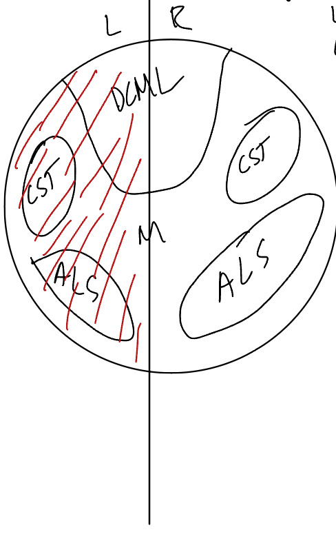 <p>What’s damaged and which side of symptoms are affected? </p>