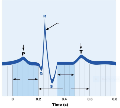 <p>What does the S-T wave represent?</p>