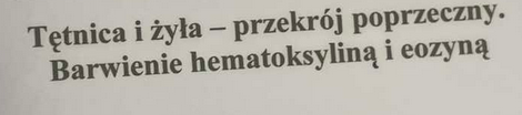 <p>tętnice - mają ściany z dużą i lością mięśni dzięki czemu mogą regulować ciśnienie płynąćej lkrwi</p><p>żyły - posiadają zastawki zapobiegające cofaniu się krwi</p>