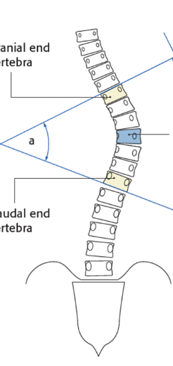 <p>what is the blue part of this spine called </p>