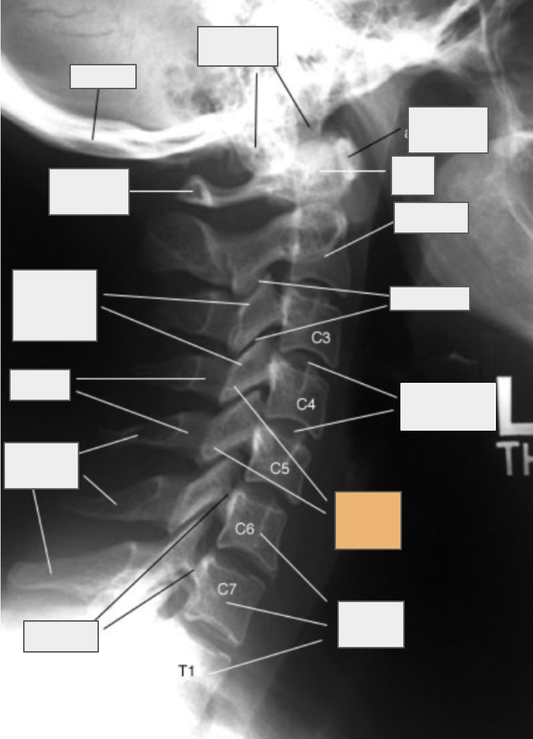 <p>What structure of the spine does the box highlighted in orange reference to?</p>