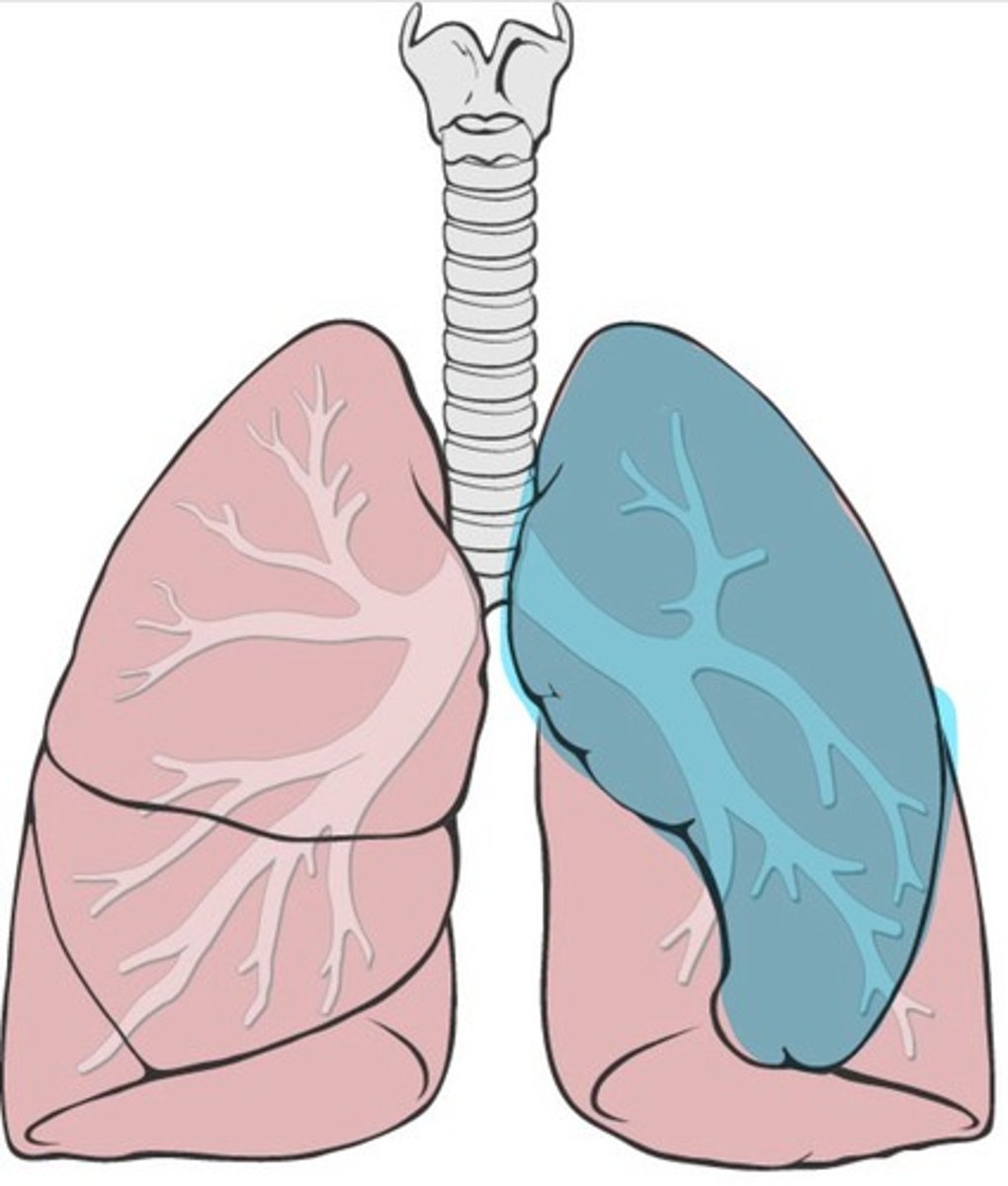 <p>Top lobe of the left lung</p>