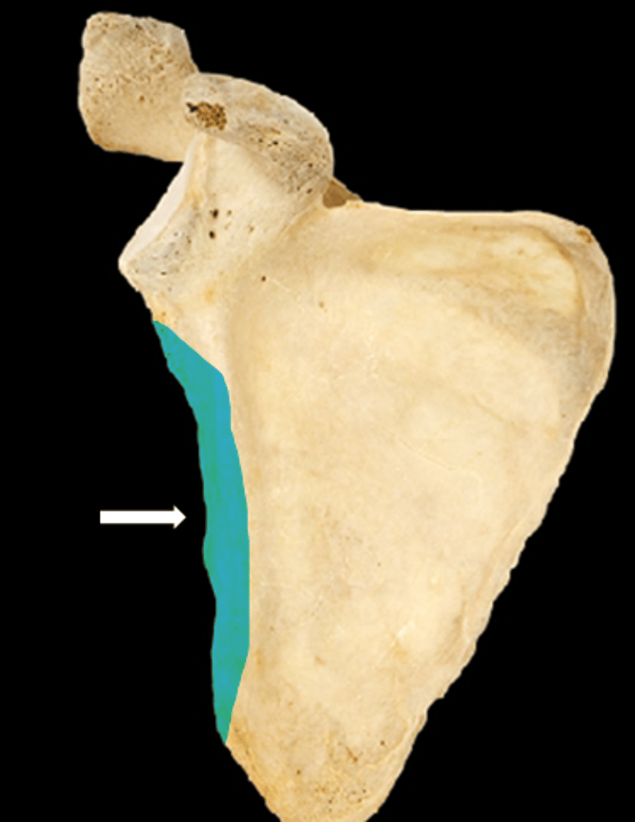 <p>name the part</p>