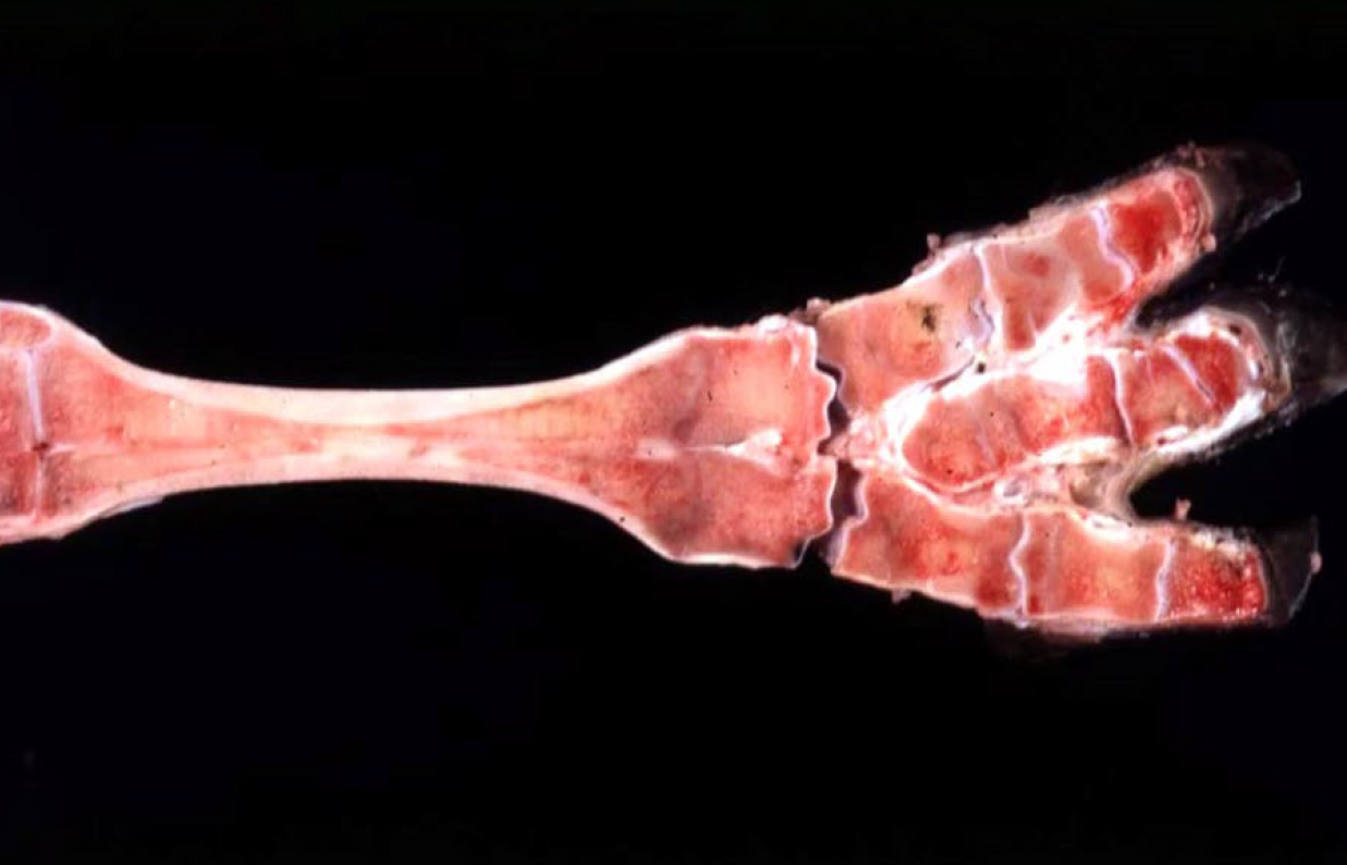 <p>Morphologic diagnosis:</p>