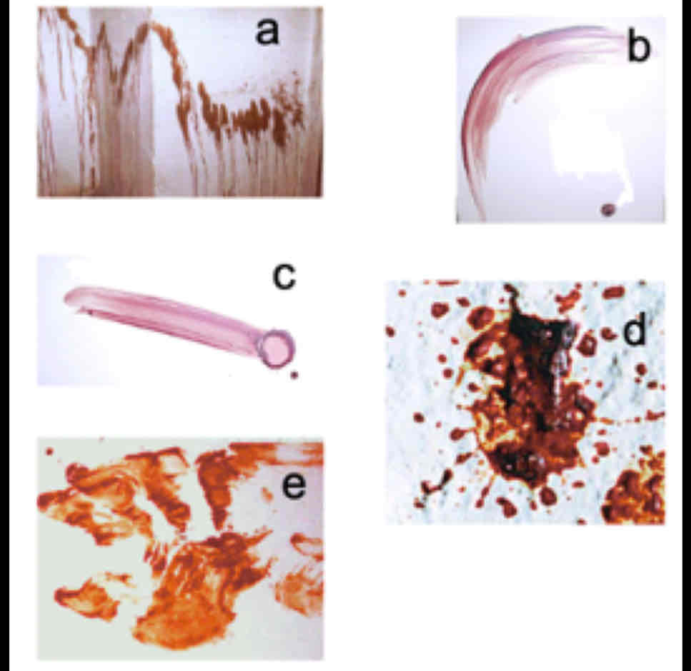 <p>What is the transfer pattern?</p>