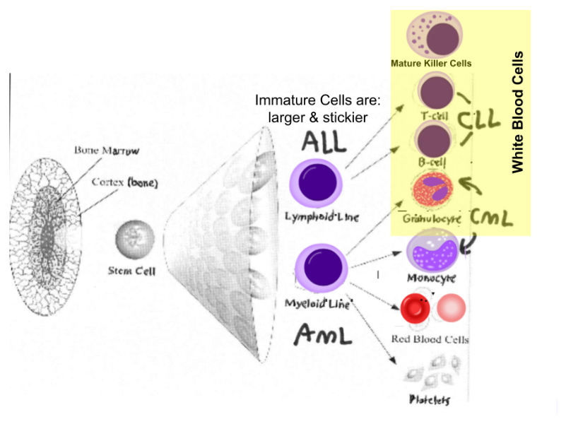 <p>Acute leukemia- arises from stem cells that go bad right away </p><p>Chronic leukemia- happens when the stem cell defect is not so prominent, and the disease progresses into chronic leukemia </p><p></p><p><em>FYI: If there is a malignant transformation of the immature lymphoid, myeloid cells, and it presents as a cancer right away → acute leukemia </em></p><p><em>If that defect does not turn into a cancer right away, then the immature cells can develop into mature cells and if they turn cancerous, it’s a chronic leukemia </em></p><p></p>