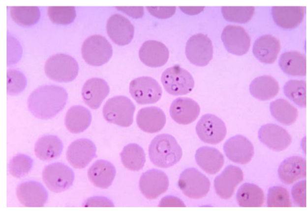 <p>What is the <strong>name</strong> of this microbe?</p>