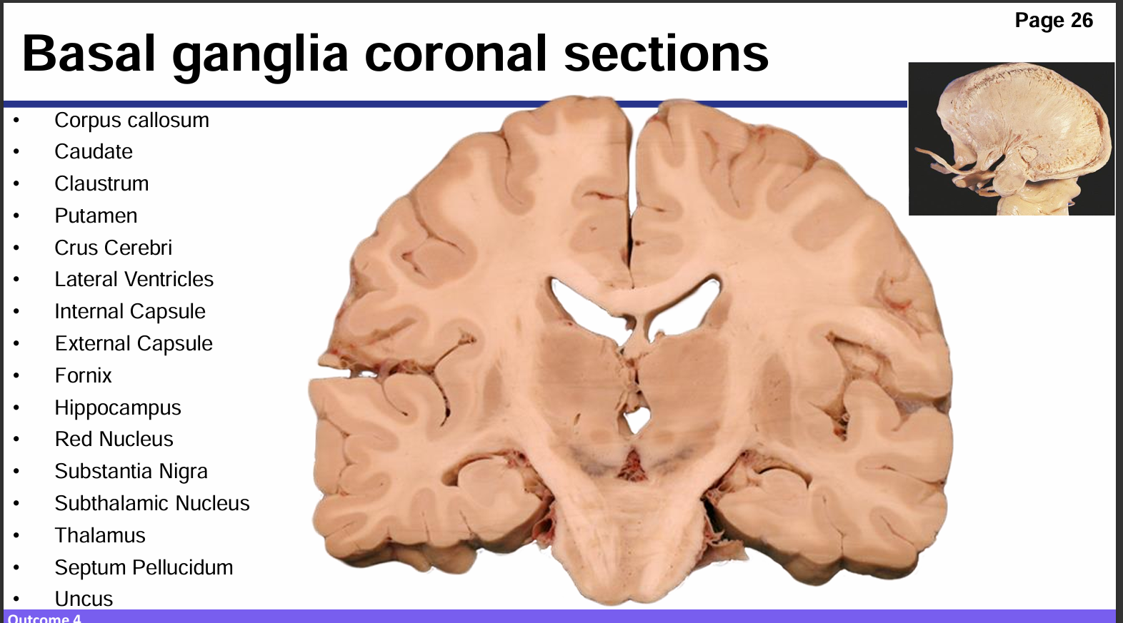 <p>Identify these structures and what part of the basal ganglia it is</p>