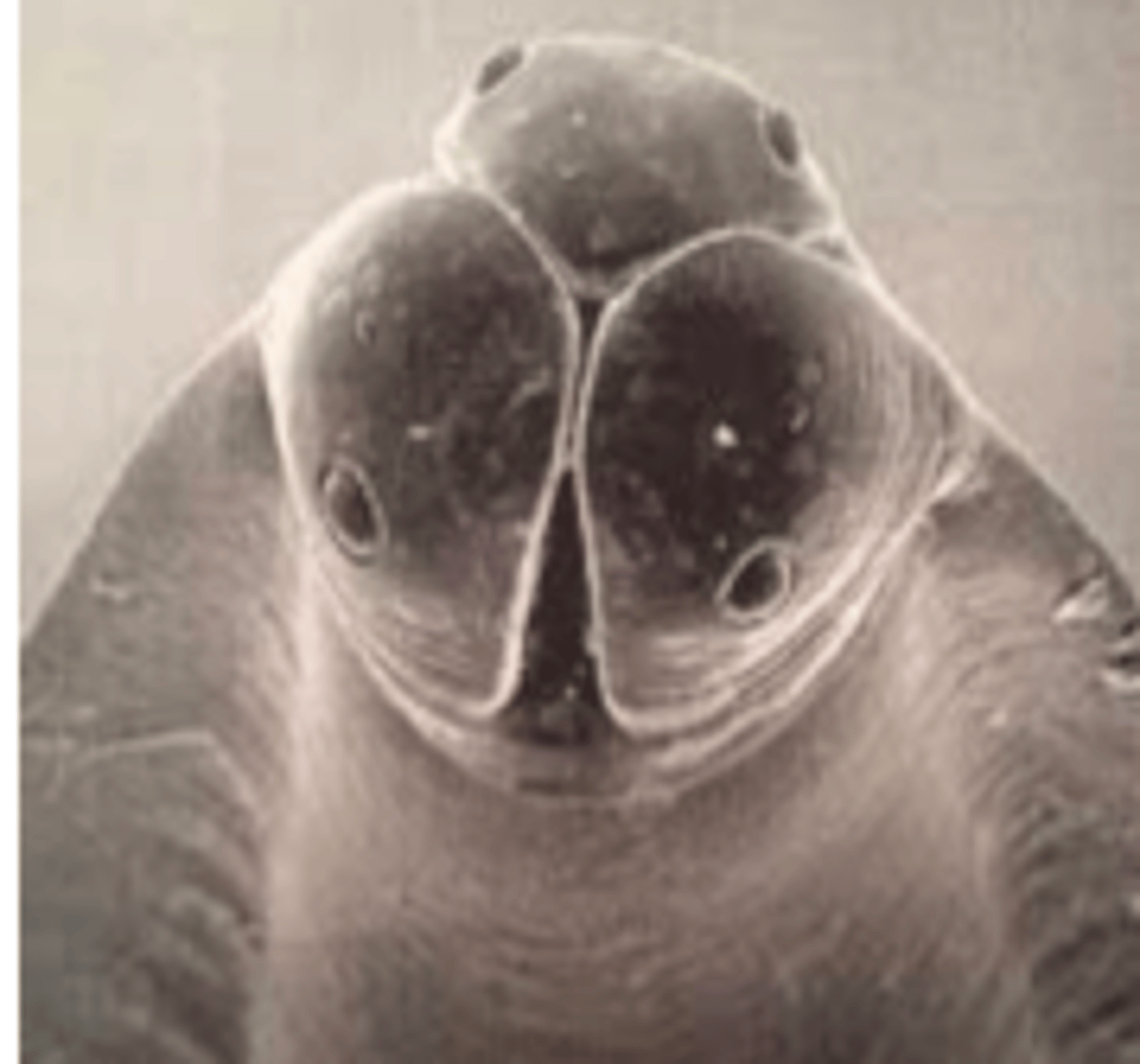 <p>Toxocara canis (Canine Roundworm)</p>