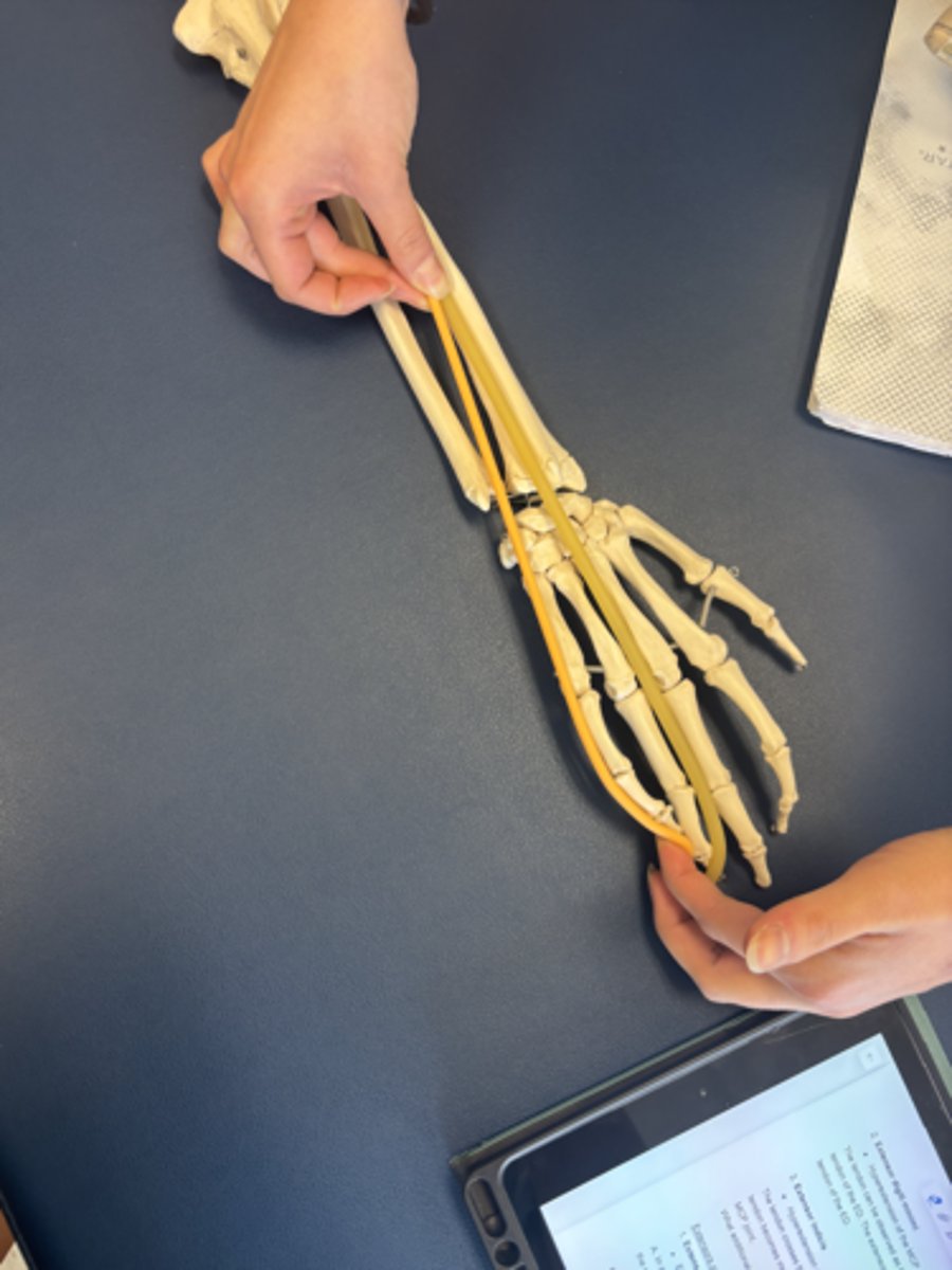 <p>What is this muscle?</p>
