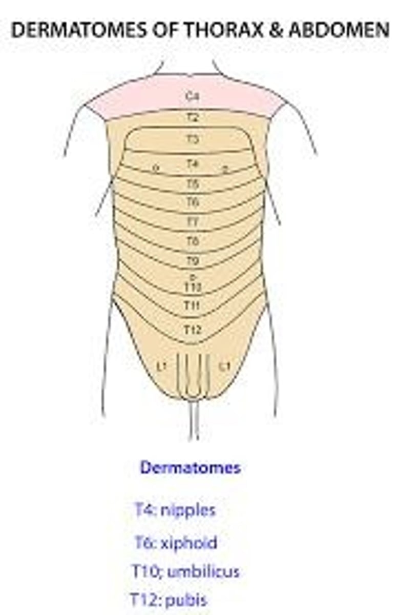 <p>Skin areas innervated by specific spinal nerves.</p>