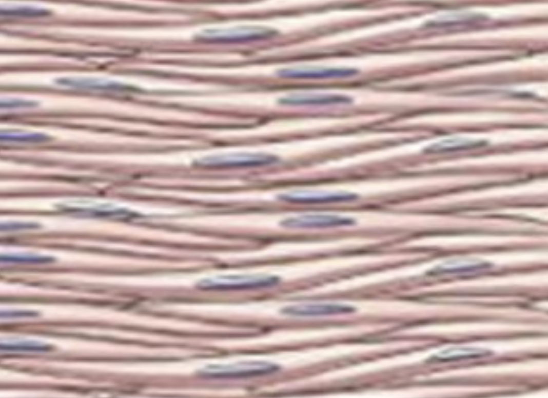 <p>what type of muscle tissue is this?</p>