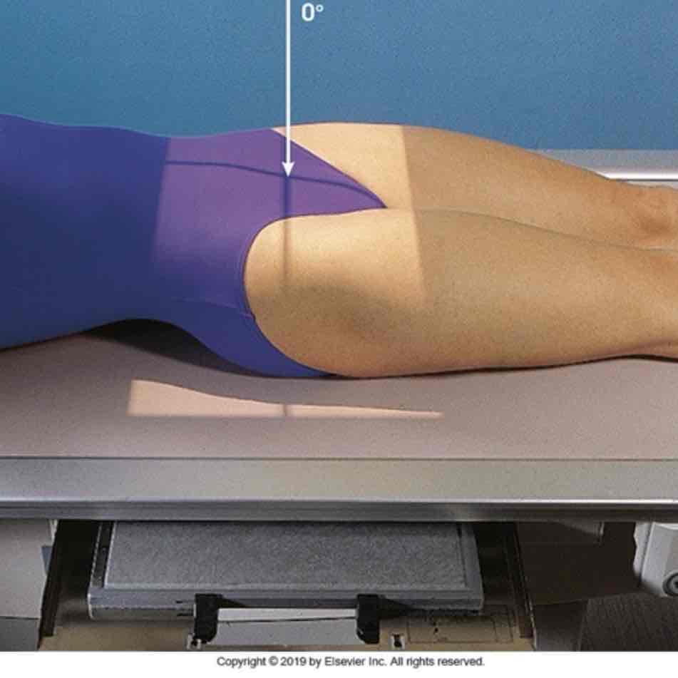 <p>What Projection is this?</p>