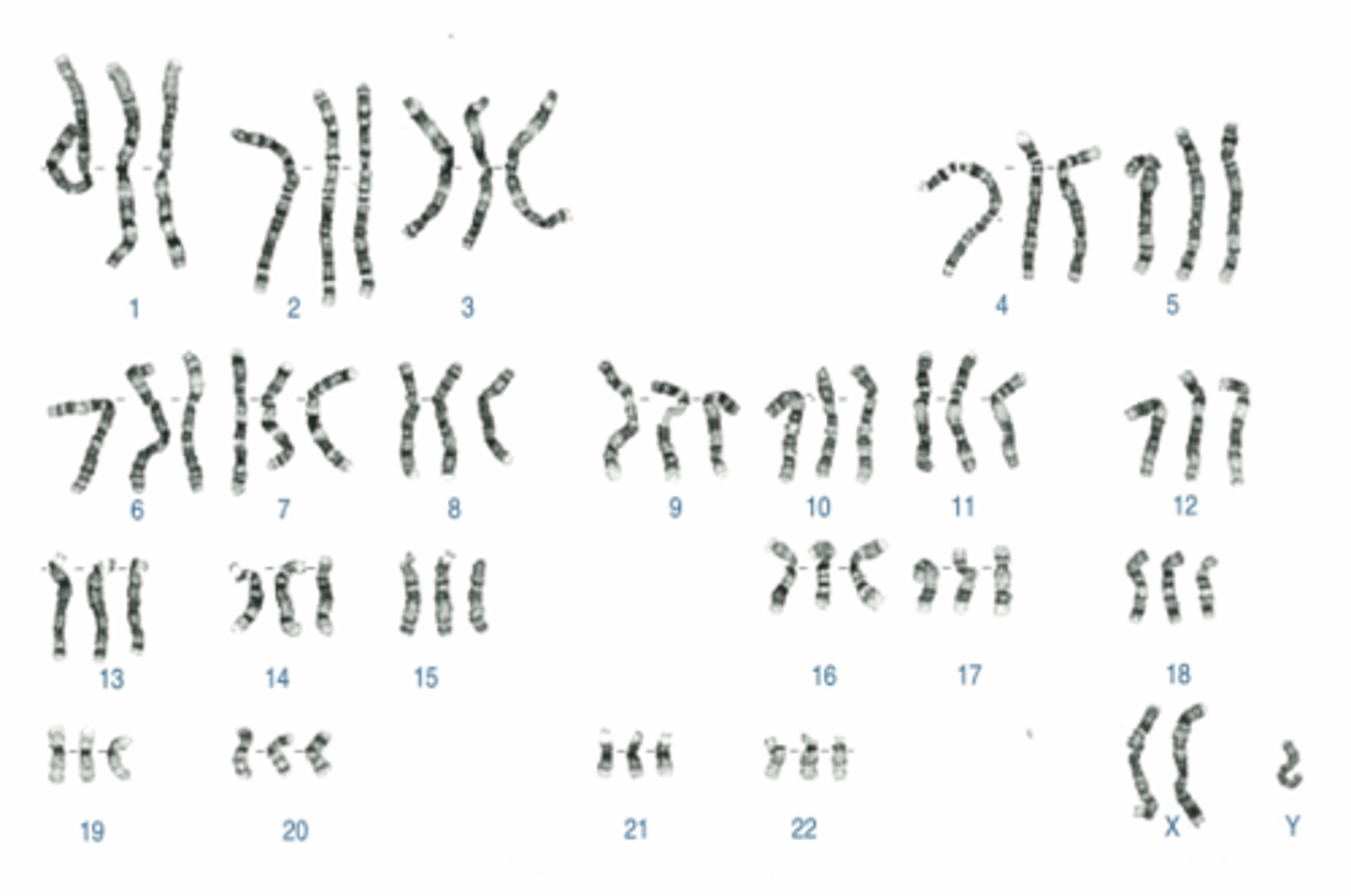 <p>Name:</p><p>- Correctly written karyotype</p><p>- Common name</p><p>- Scientific name</p><p>- One distinguishing clinical feature</p><p>- Definition of this feature if not obvious</p>