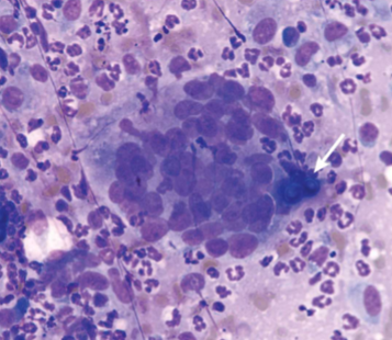 <p>what does&nbsp;<span style="color: rgb(255, 255, 255);"><span>Blastomyces dermatitidis infect&nbsp;</span></span></p>